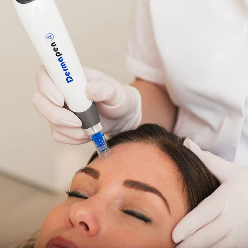 Microneedling behandeling in huidkliniek